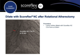 Scoreflex Case Summary slide 11