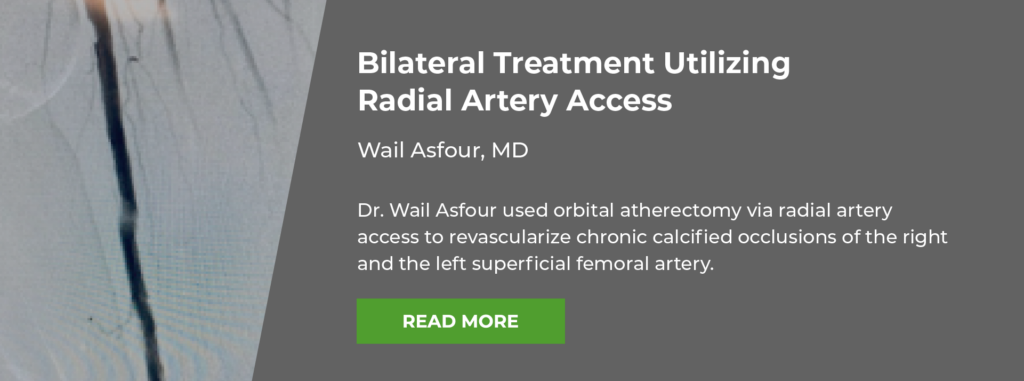 Radial Artery Access
